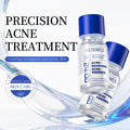 SY1WM0009-Acne Clear Anti-Acne 10ml